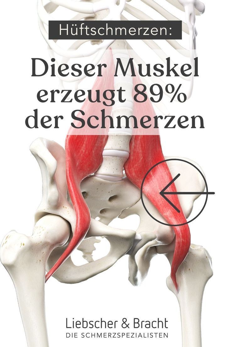 Schmerzen in der Hüfte: Hier klicken & diesen Muskel dehnen! Schmerzen in der Hüfte: Hier klicken & diesen Muskel dehnen!
